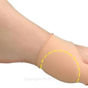 Visco-GEL Bunion Relief Sleeve